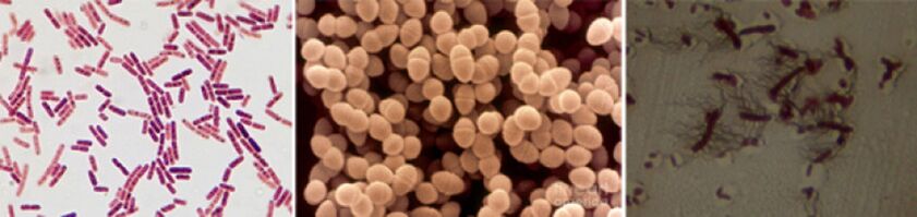 E. coli, fecal enterococcus and proteus are the main etiological agents of chronic bacterial prostatitis