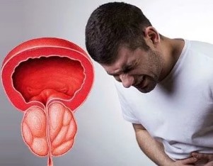The symptoms of chronic prostatitis in men